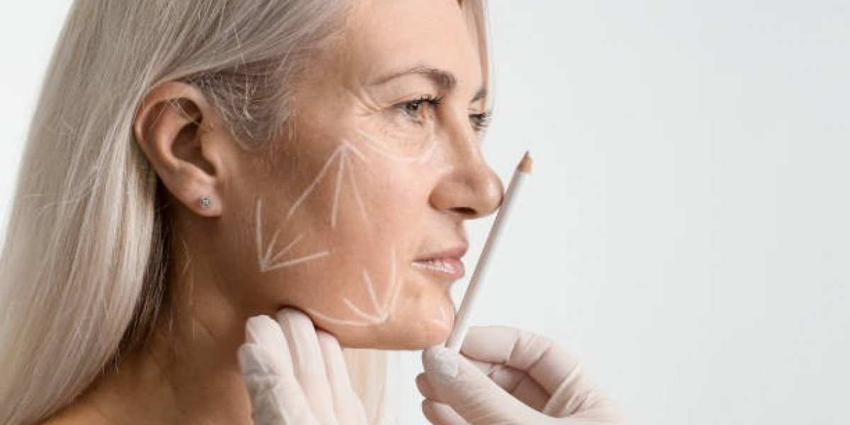 Can You Combine a Facelift with Neck Lift or Eyelid Surgery?