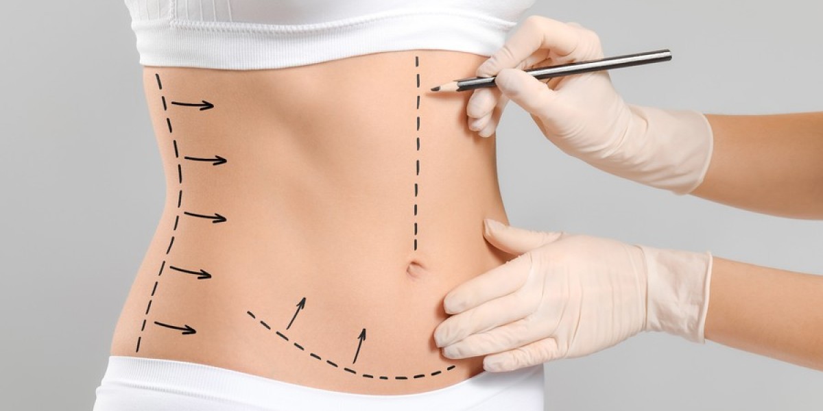 How to Maintain Results Long-Term After Tummy Tuck in Islamabad