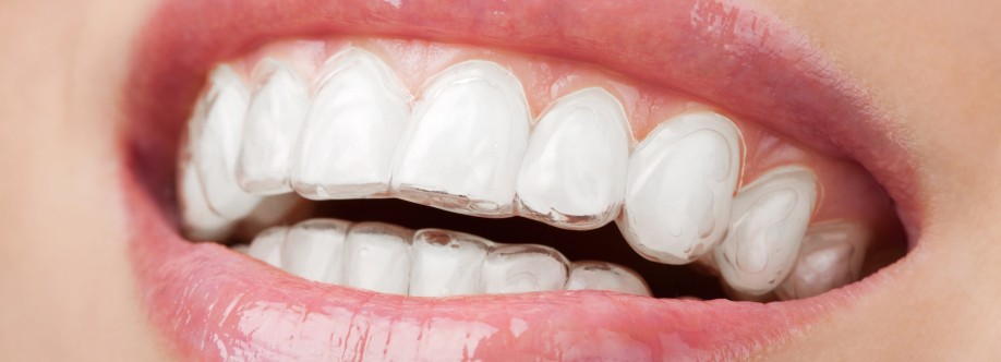 Dental Implants Benefits Cover Image