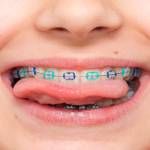 Guide to Dental Implants Profile Picture